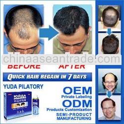 men hair treatment/hair regrowth/hair growth